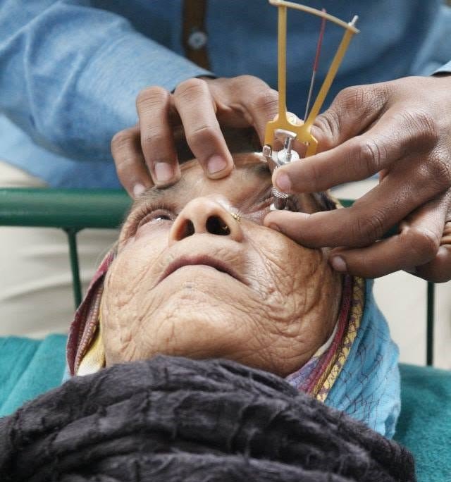 Cataract Surgery